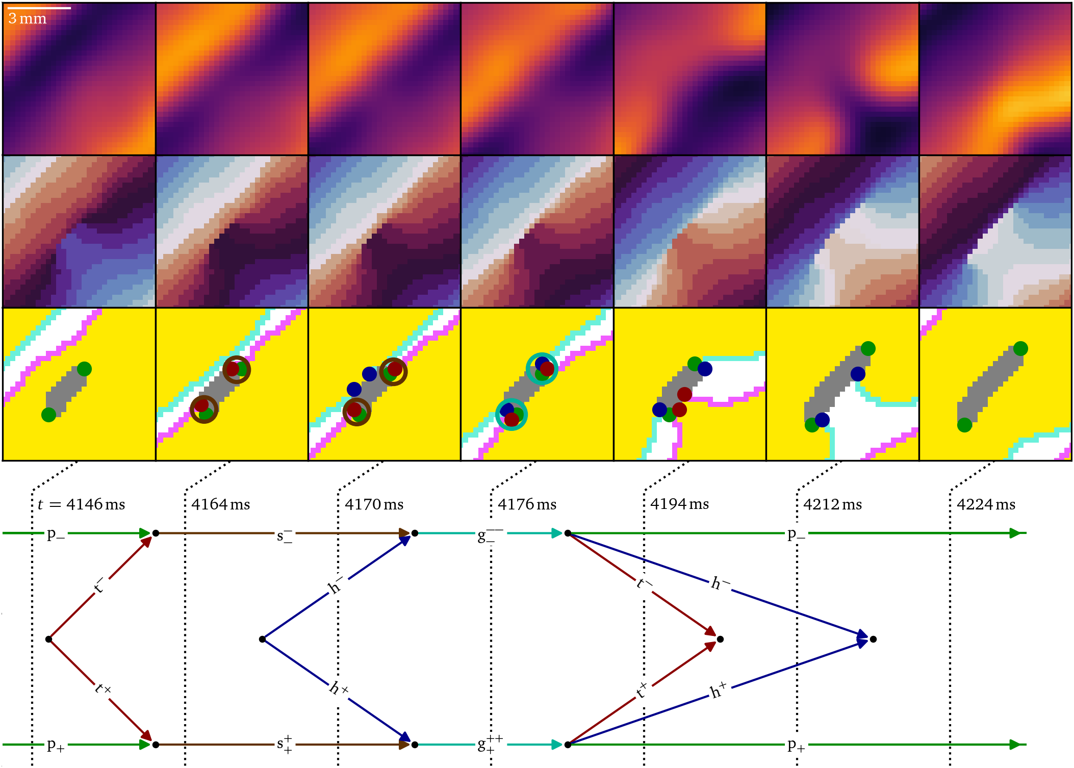 Accumulation of conduction block