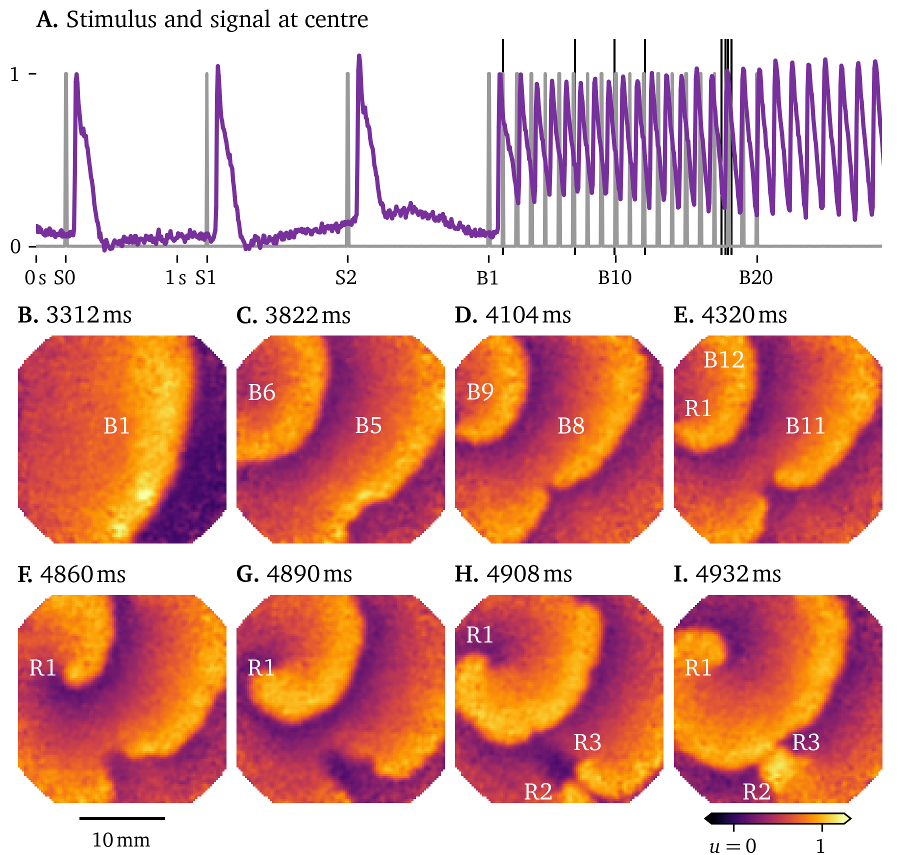 Figure-of-eight spiral formation under burst pacing in hiAM monolayers
