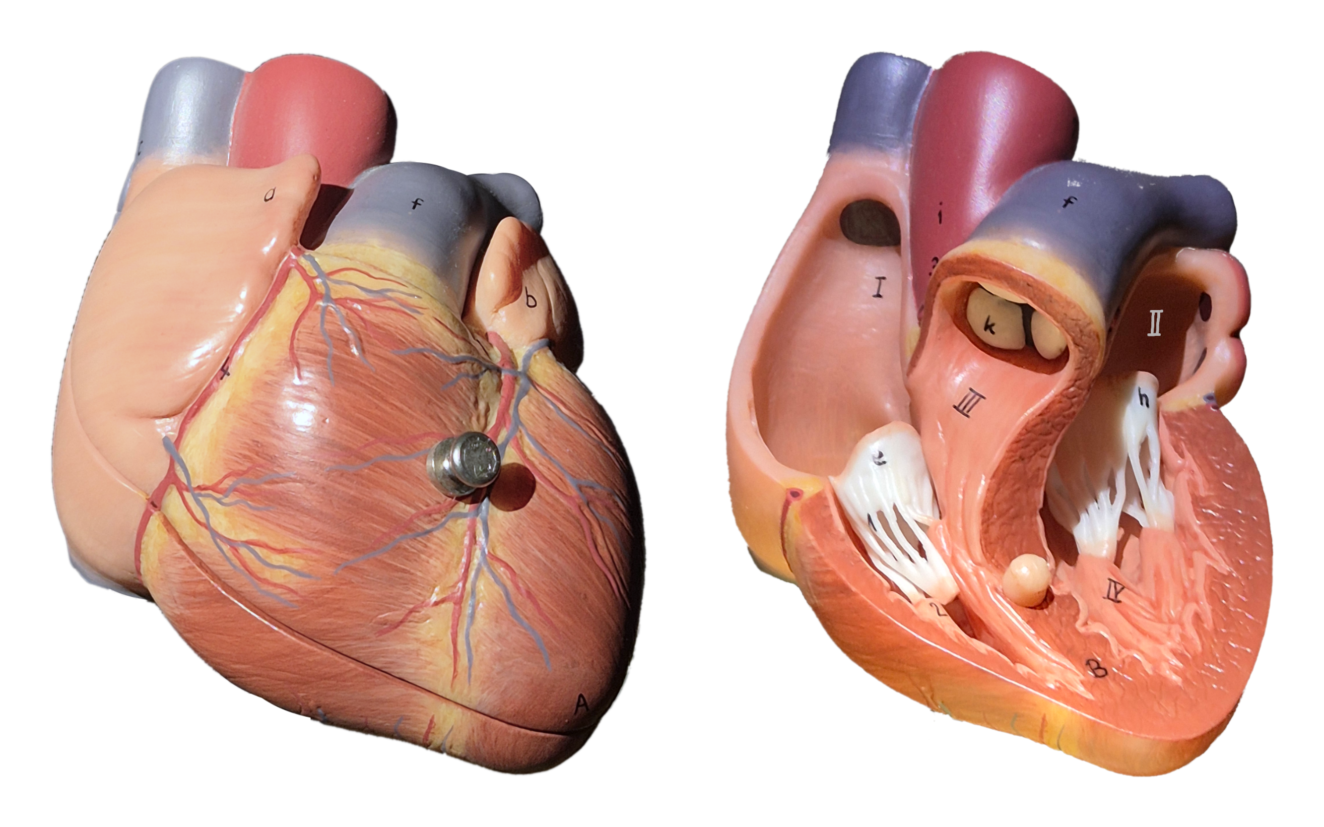 Anterior view of the human heart