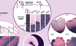 Featured image of post Pigreads: The Python-integrated GPU-enabled reaction-diffusion solver using OpenCL for cardiac electrophysiology and other applications